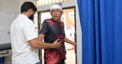 যশোরে অভিনেতা সমু চৌধুরীর ওপর হামলা, মাথায় চার সেলাই