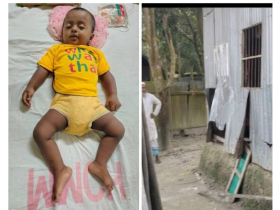 জমি সংক্রান্ত বিরোধকে কেন্দ্র করে দেড় বছরের শিশুর মাথায় আঘাত!