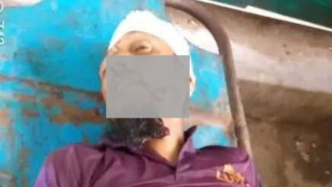 মাগুরায় গাছ কাটতে গিয়ে ডাল ভেঙে সড়কে পড়ে ব্যক্তির মৃত্যু