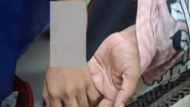 লামায় কুকুরের কামড়ে ১৩ জন গুরুতর আহত
