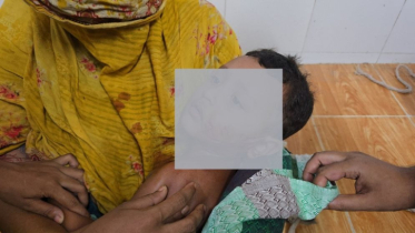 সাঁথিয়ায় পাগলা শিয়ালের কামড়ে শিশুসহ আহত ১১